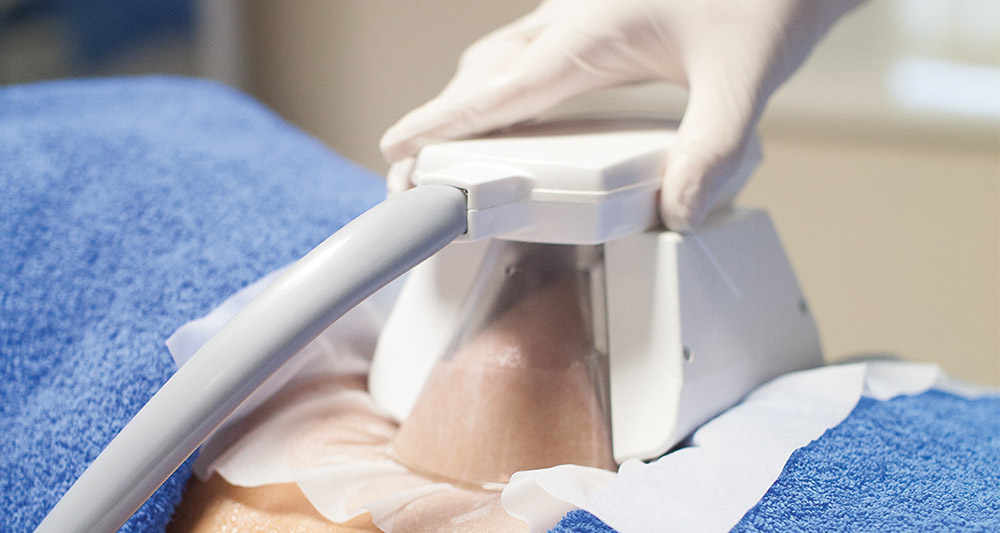 How Fat Freezing and HIFU Work Together? 2 Multiple Areas in One Session HIFU and Fat Freezing Camberley