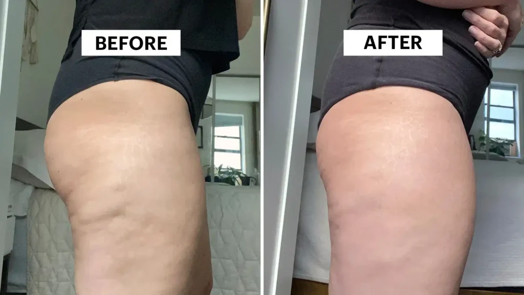 Do Toning Exercise Camberley Really Tackle Cellulite?