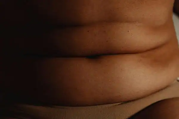 The Hidden Connection: How Stress Shapes Your Fitness and Body Composition 3 image of what stress can do on the stomach area and how Lipo 360 Camberley can help to change your body shape.