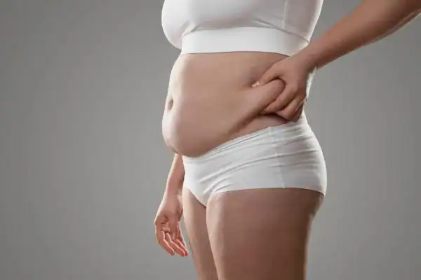 Image of stress belly Camberley How Lipo 360 can help manage your symptoms