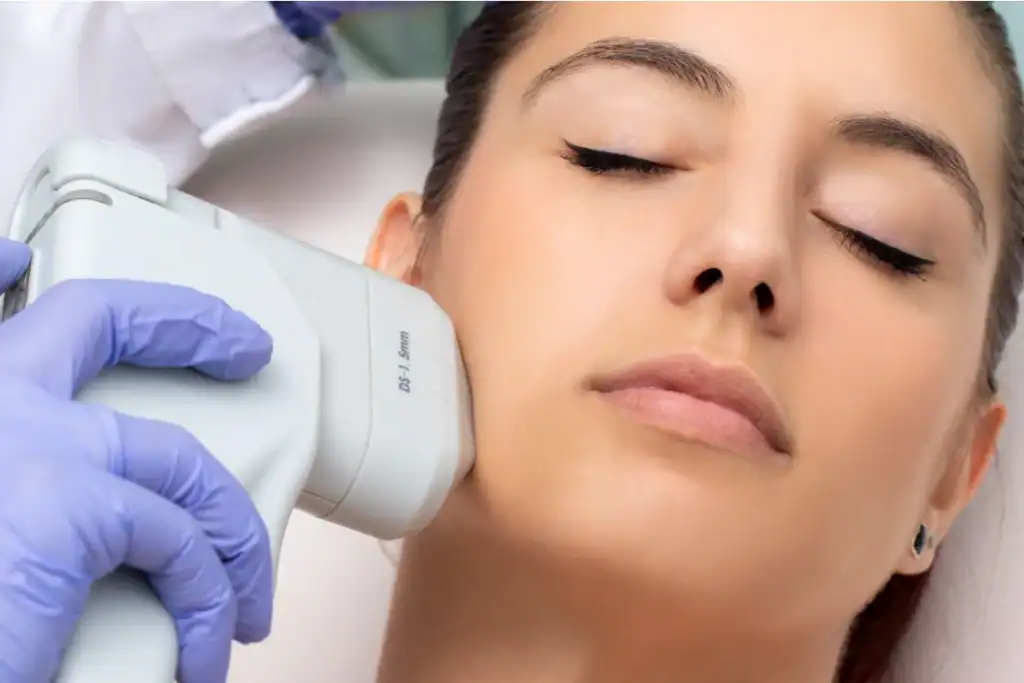 Discover the Perfect Duo: RF Microneedling and HIFU 2 Image of Morpheus8 And HIFU Combined with Lipo 360 Camberley