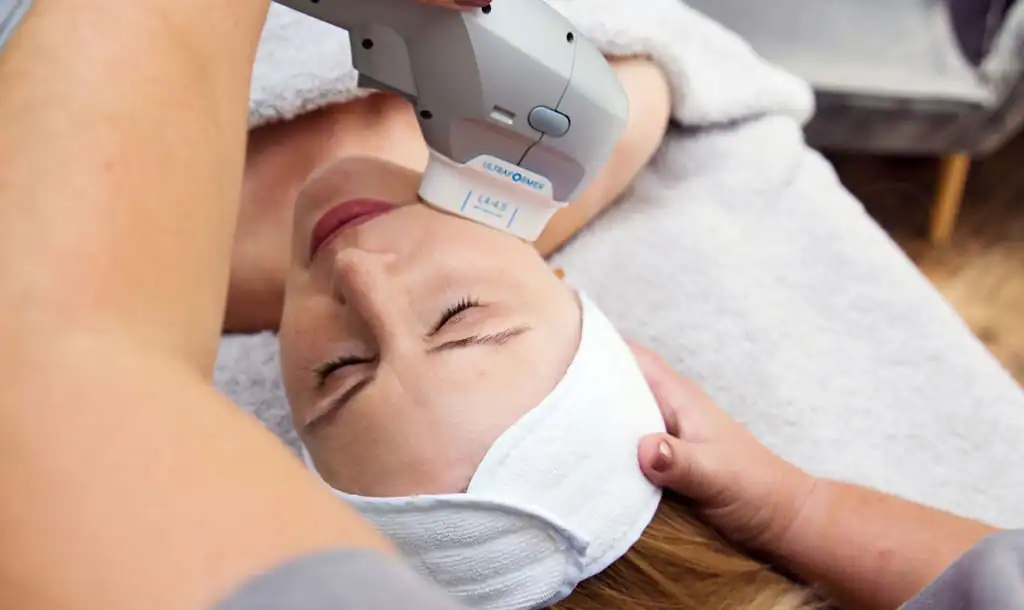 Discover the Perfect Duo: RF Microneedling and HIFU 1 Image of Morpheus8 And HIFU Camberley combined treatment